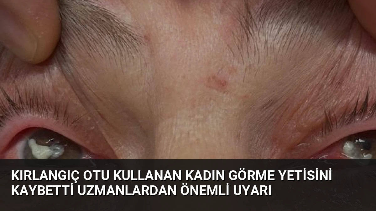Kırlangıç Otu Kullanan Kadın Görme Yetisini Kaybetti Uzmanlardan Önemli Uyarı