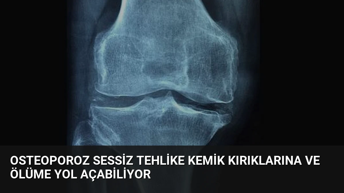 Osteoporoz Sessiz Tehlike Kemik Kırıklarına ve Ölüme Yol Açabiliyor