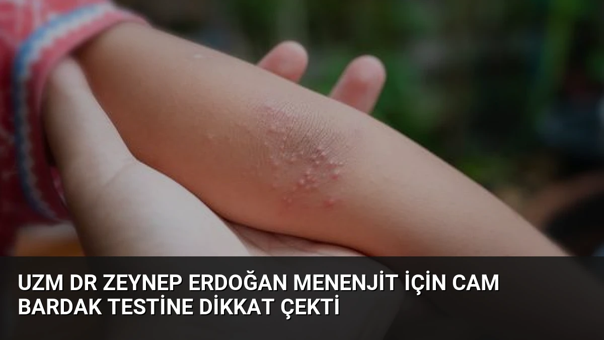 Uzm Dr Zeynep Erdoğan Menenjit İçin Cam Bardak Testine Dikkat Çekti