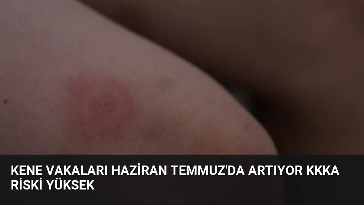 Kene Vakaları Haziran Temmuz’da Artıyor KKKA Riski Yüksek